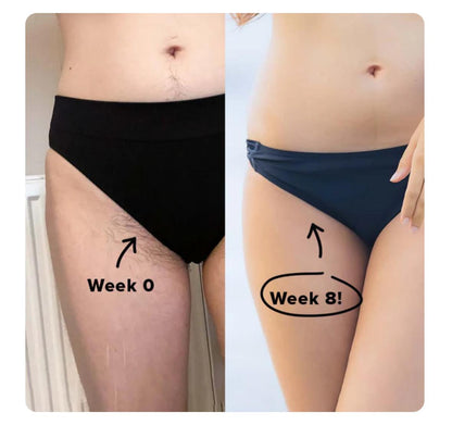 Debaskin's IPL Laser Hair Removal Handset
