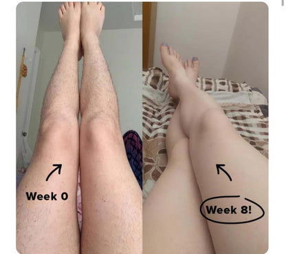 Debaskin's IPL Laser Hair Removal Handset