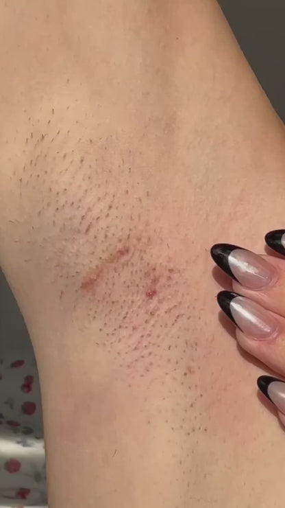 Debaskin's IPL Laser Hair Removal Handset